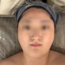 더반하다뷰티 | 세종피부관리 제대로 받고 온 후기, 뷰티에 반하다 줄기세포관리