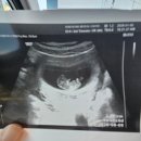 태안군청소년수련관 | 태안군 찾아가는 산부인과 정기검진 초음파 후기(무료, 예약방법, 주차)