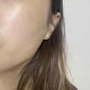 바이브 | 스킨바이브 효과 후기