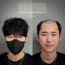 당신이연출한머리코스메틱 | 부산남자가발, 너 요즘 관리받냐?" 소리 듣게 만드는 가발의 비밀