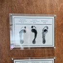 굿피트코리아 | 평발교정 굿피트코리아 제1사업본부｜하루 종일 서서 일하는 남편 발 상담 후기