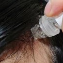 머리카락 굵어지는법 자란다 두피 MTS앰플 스킨부스터 홈키트 후기