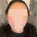 대구동성로예쁨주의쁨의원 | 대구 동성로 피부과 스킨부스터 필로드 예쁨주의쁨의원