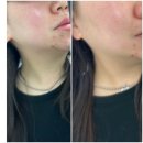 서면베르빌2 | 서면 꼼꼼한 피부관리 더 리드 스튜디오 압출, 홍조, 진정