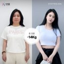 더마름다이어트