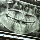 이지플란트치과의원 이미지