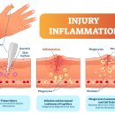 하이퍼스트 이미지
