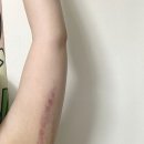 [대연동 피부관리] 라퓨어왁싱&amp;스킨케어