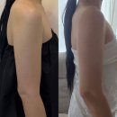 CU(서산서궁팰리스점) | 서산에스테틱 서산웨딩관리 루아뷰티 슬림젯 지방분해 팔뚝 후기