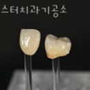 마이스터 기공소 이미지