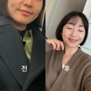 미소가인피부과의원 | 대구 수성구피부과 울쎄라 400샷 맞고 온 솔직 후기 가격 유지기간