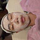 [통영 사춘기 여드름 관리] 하얀얼굴 통영점 후기! 왕여드름·건조피부 관리 솔루션