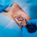 성모진안과의원 이미지