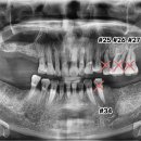 뿌리심는치과의원 이미지
