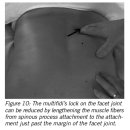 다열근(cervical multifidus, thoracic multifidus, lumbar multifidus) 이미지