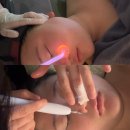 롯데마트 장암점앞 | 의정부피부관리 찐 만족했던 롯데마트장암점 미플 트러블관리 후기