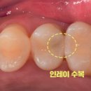 부천한결치과의원 이미지