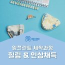 하이엔드 치과기공소 이미지