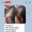 리코두피탈모관리