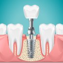 서울나란이치과교정과치과의원 이미지