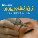 신촌 아이라인문신제거병원 후기 레이저 선택 기준 | 연세스타피부과
