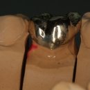 민치과기공소 이미지