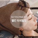 하이퍼들 | 일산두피관리 웰킨 두피탈모센터 | 두피 버블스케일링 가격, 솔직후기