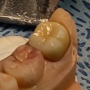 수인치과기공소 이미지