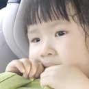 봄뜰 어린이집 뒷길 | 두돌 아기 열안나는 노란 눈꼽감기 알레르기성 결막염 증상 및 치료후기