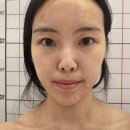 내서읍381 | 마산 내서 더앤뷰티 에스테틱 여드름피부 추천 피부진정관리 내돈내산 솔직 후기