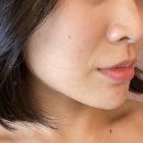 지온메디칼 이미지