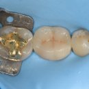 세라믹치과기공소 이미지