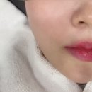 ICHEON111 | 이천 수분관리/mts 피부관리 만족 후기 '아비에 피부왁싱 이천'