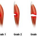 이재규 스포츠 재활 이미지