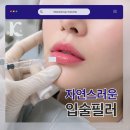 케이스타의원 | 광주입술필러 cc보다 중요한 것은 따로 있습니다 수완지구필러 정보