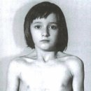 rehabilitation of spine - managing common syndrome &amp; finding the key link 이미지