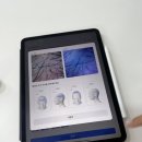 혜민웨이 | 강남 이수역 탈모관리 혜민웨이, 자연스러운 정수리 SMP 후기