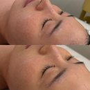 매영로310번길 | [ 수원 영통역 ] 영통피부관리 올가드림뷰티 영통신나무실점 모공관리 솔직후기