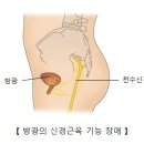 방광의 신경근육 기능 장애[Neuromuscular dysfunction of bladder] 신장 비뇨기질환 이미지