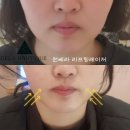 최강메디컬그룹 | 충주피부관리 원쎄라 충북최초인증교육센터 (오라클메디컬그룹소속)리얼후기