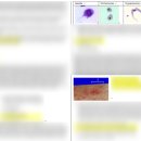 HY 여수점 | [USMLE STEP1] 80일의 전사 PASS 후기!/공부방법/정리본/NBME점수변화기록/공부링크