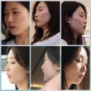 뽀송몰