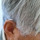 서울탑보청기 이미지