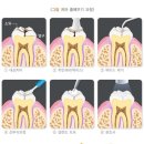 [연합뉴스]소아·청소년 충치예방치료 본인부담 30%→10% 경감 이미지