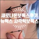꼼꼼한후기- 새로나온 뉴럭스 사각턱보톡스 후기