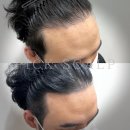 픽스칼프 이미지
