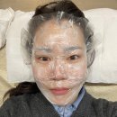 디벨롭바이크 | 25. 03 기록 ( 레이저토닝 5회차, 동대문종합시장 )