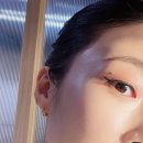 논현사우나 | 인천논현피부과 스킨부스터 리쥬란 대신 통증 없는 에버클 후기