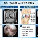 바이메드주 | [공지] 진주 십자인대 재활 얼마나 걸리나요? 핵심 3가지