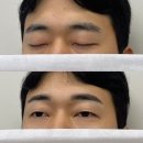 눈썹공쥬 - 부평구 | 리메이드 옥정점 눈썹문신 내돈내산 후기💛 콤보 시술 기록!